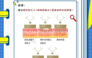 黄金微针的功效和作用加pap是什黄金微针的功效和作用