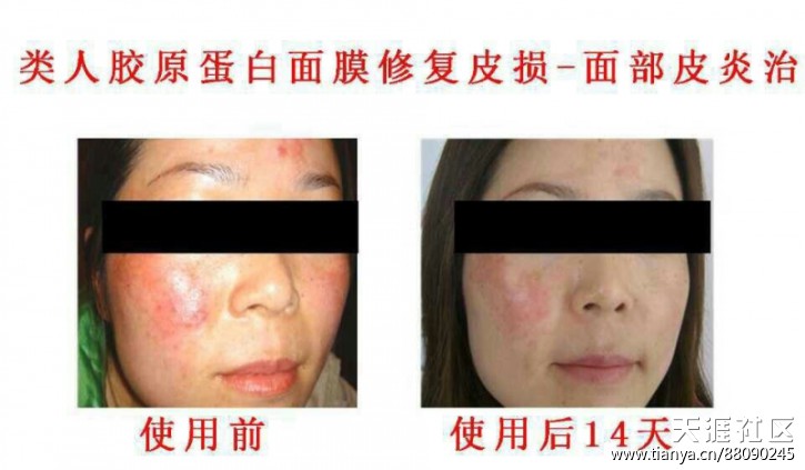 俏十岁 万色水母 蓝蓓丽 华佗 It's skin 近两年时尚界新宠-第5张图片-翡翠网