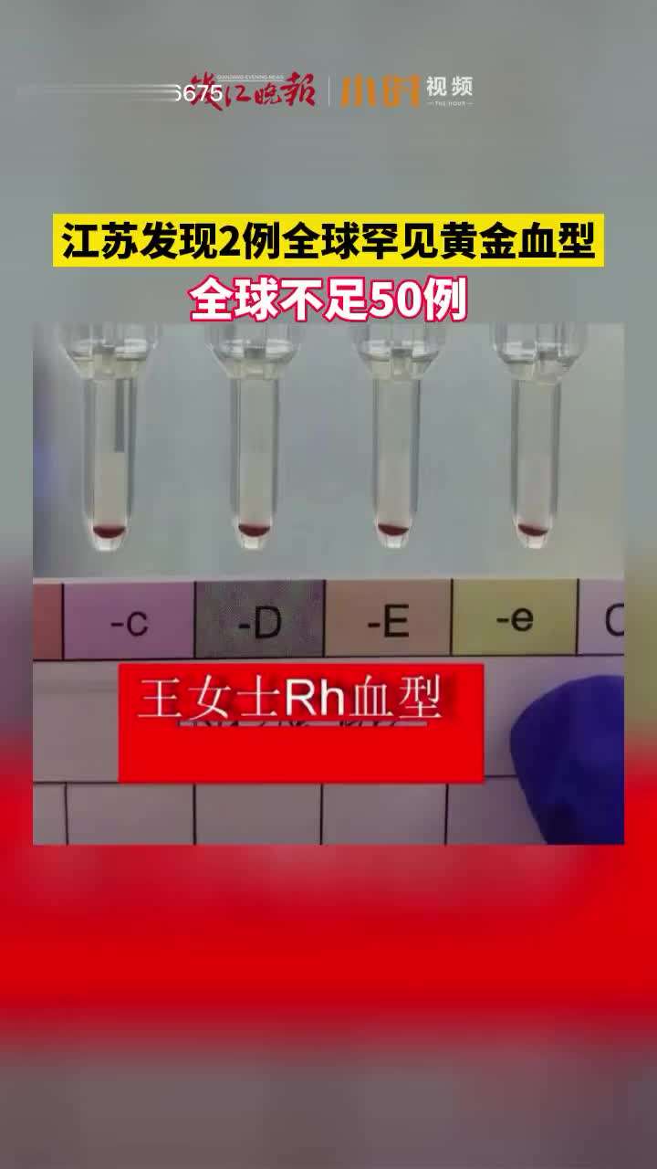 黄金血型rh黄金血型-第1张图片-翡翠网