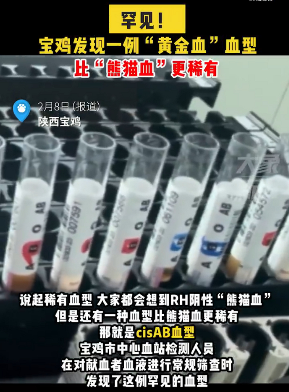 全球罕见黄金血型一,全球罕见黄金血型-第1张图片-翡翠网