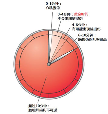 包含心源性猝死黄金救命时间是几分钟的词条-第1张图片-翡翠网